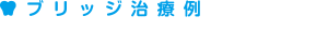 ブリッジ治療例